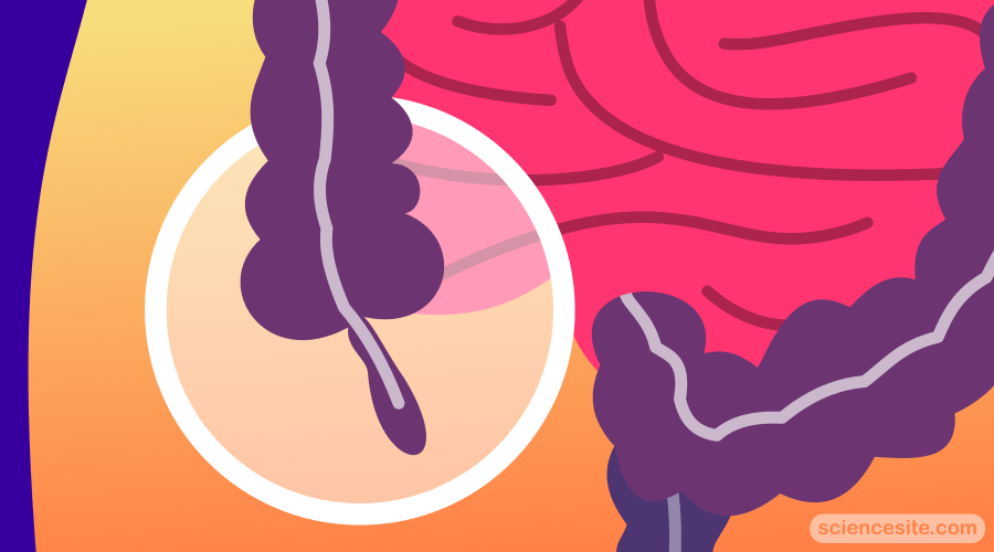 What is Appendix and Why Do We Have it in the First Place? Thumbnail